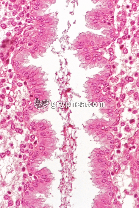 Endomètre phase sécrétoire x100 - gryphea.org